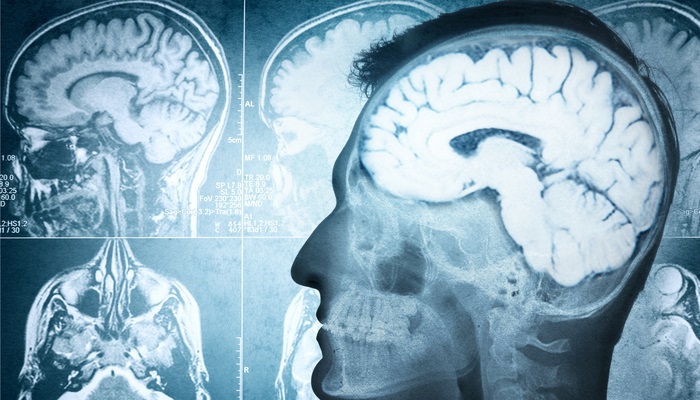 Un estudio registra el aumento de la actividad cerebral al aprender idiomas