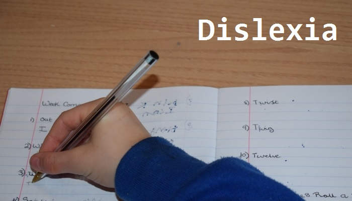 Dislexia: la culpa no es del cerebelo
