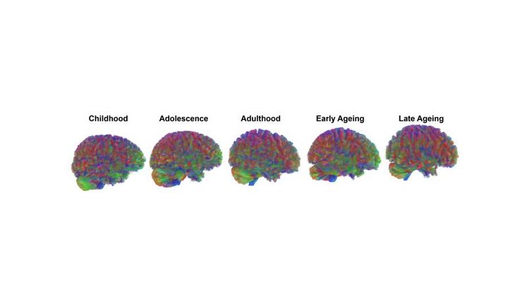 De la infancia a la vejez: las edades clave del cerebro humano según Cambridge